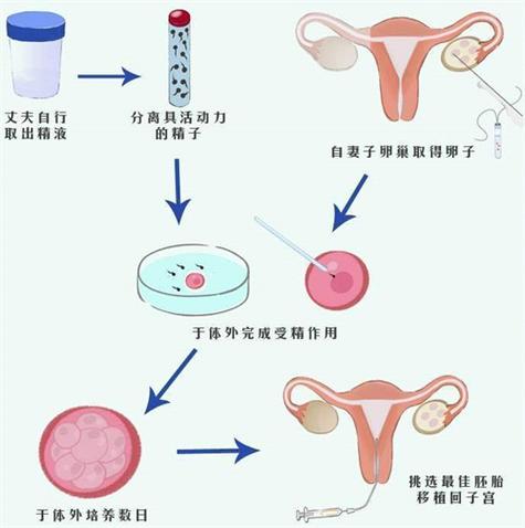 供卵试管医院哪里做的好-供卵试管医院哪里做的好,选择哪家更靠谱?